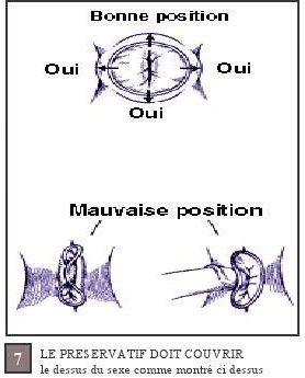 LE PRESERVATIF DOIT COUVRIR le dessus du sexe comme montre ci dessus