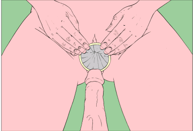 Zeichnung zeigt richtige Femdiom-Nutzung